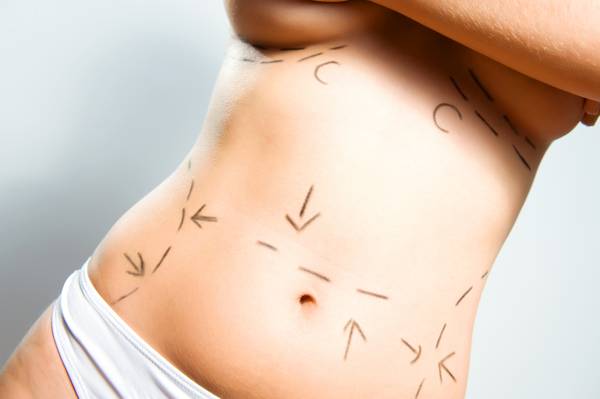 tummy tuck Williamsville, NY